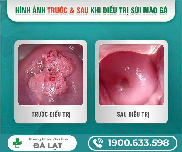 Hình ảnh minh họa